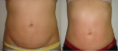 /album/galeria-de-fotos-mariana-sato/cs-png1/