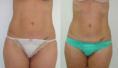 /album/galeria-de-fotos-mariana-sato/nb-a-png/